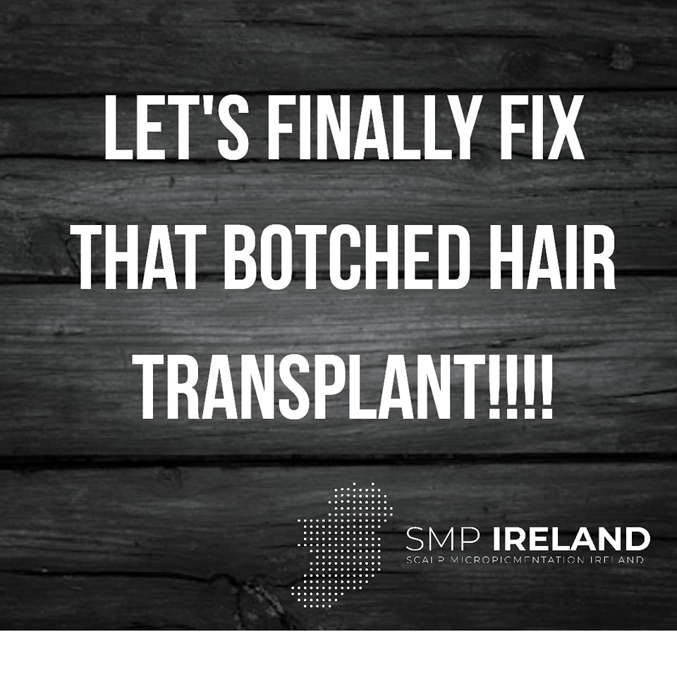 So many bad hair transplants out there. You're not stuck, book a free consultation to go through your options!!!
Scalp Micropigmentation is a pmu procedure that uses a method similar to a tattoo to replicate hair follicles on your scalp. No hair grows from this procedure.
At SMP Ireland:
We tailor each hairline to every individual client.
We restore the image of having a full head of hair
We only use the highest standard quality products to ensure you get the best look.
No bleeding, no swelling and no scabbing.
Any redness disappears within 24 hours.
Some of the things we tackle are the following:
Thinning hair
Receding hairlines
Add hair density
Create symmetry
Male pattern baldness
Female pattern baldness
Alopecia
Hair loss.
FUT and FUE scarring camouflage
If interested DM, text, call email or check my website for quotes.
All consultations are free and payment plans are available.
Please feel free to follow to see our customer transformations.
Based in Limerick city, Ireland serving Ireland.
#beboldnotbald #trusttheprocess #pmuireland #smpireland #limerickcity #limerick
#limerickbusiness #bald #hair #scalpmicropigmentationireland #hairloss #balding #beautyireland #aestheticireland #baldingsolutionireland #confidencerestored
#SixNations2025 #irishownedbusiness