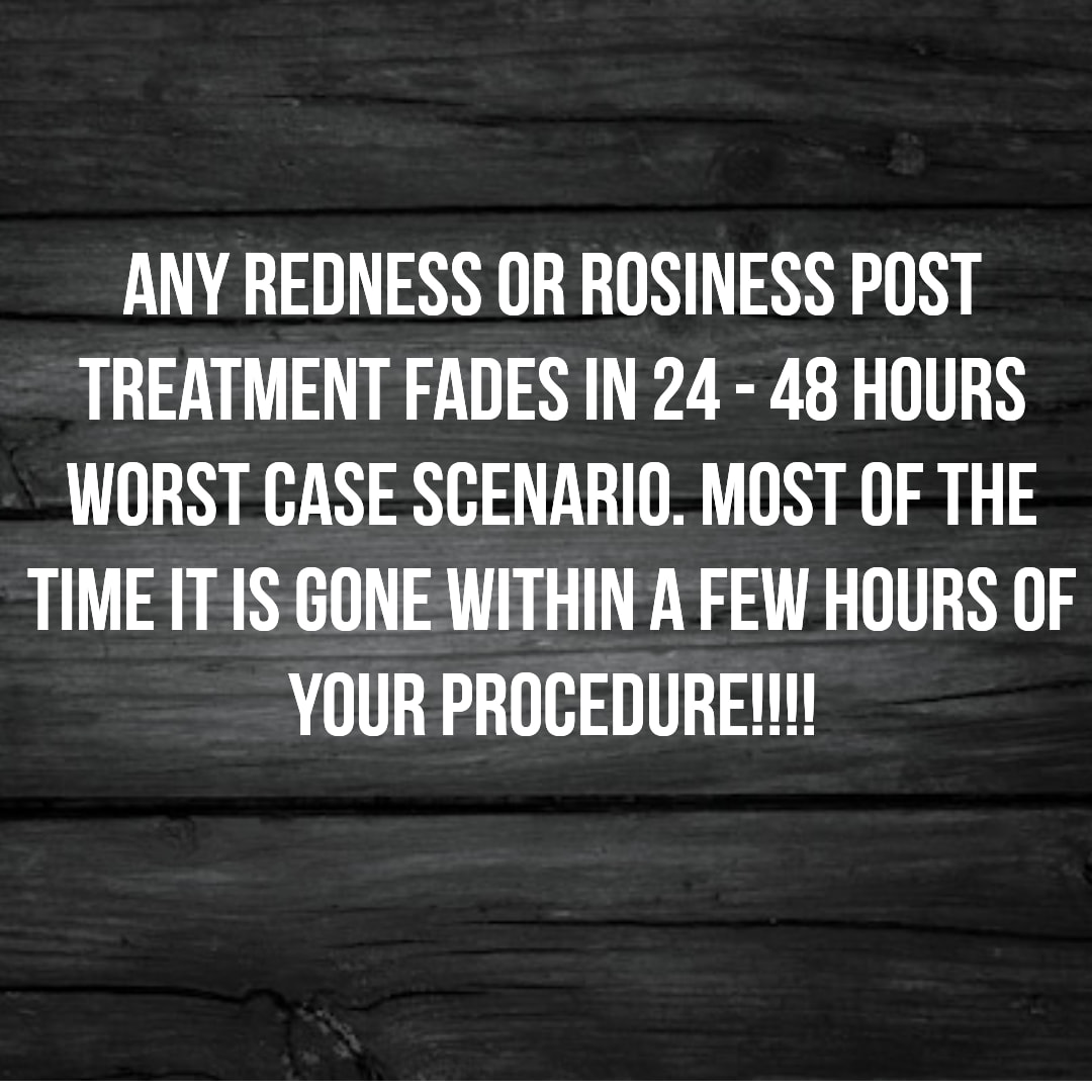Rosiness and redness doesn't stick around!!!!
Scalp Micropigmentation is a pmu procedure that uses a method similar to a tattoo to replicate hair follicles on your scalp. No hair grows from this procedure.
At SMP Ireland:
We tailor each hairline to every individual client.
We restore the image of having a full head of hair
We only use the highest standard quality products to ensure you get the best look.
No bleeding, no swelling and no scabbing.
Any redness disappears within 24 hours.
Some of the things we tackle are the following:
Thinning hair
Receding hairlines
Add hair density
Create symmetry
Male pattern baldness
Female pattern baldness
Alopecia
Hair loss.
FUT and FUE scarring camouflage
If interested DM, text, call email or check my website for quotes.
All consultations are free and payment plans are available.
Please feel free to follow to see our customer transformations.
Based in Limerick city, Ireland serving Ireland.
#beboldnotbald #trusttheprocess #pmuireland #smpireland #limerickcity #limerick
#limerickbusiness #bald #hair #scalpmicropigmentationireland #hairloss #balding #beautyireland #aestheticireland #baldingsolutionireland #confidencerestored
#redness #rosiness
