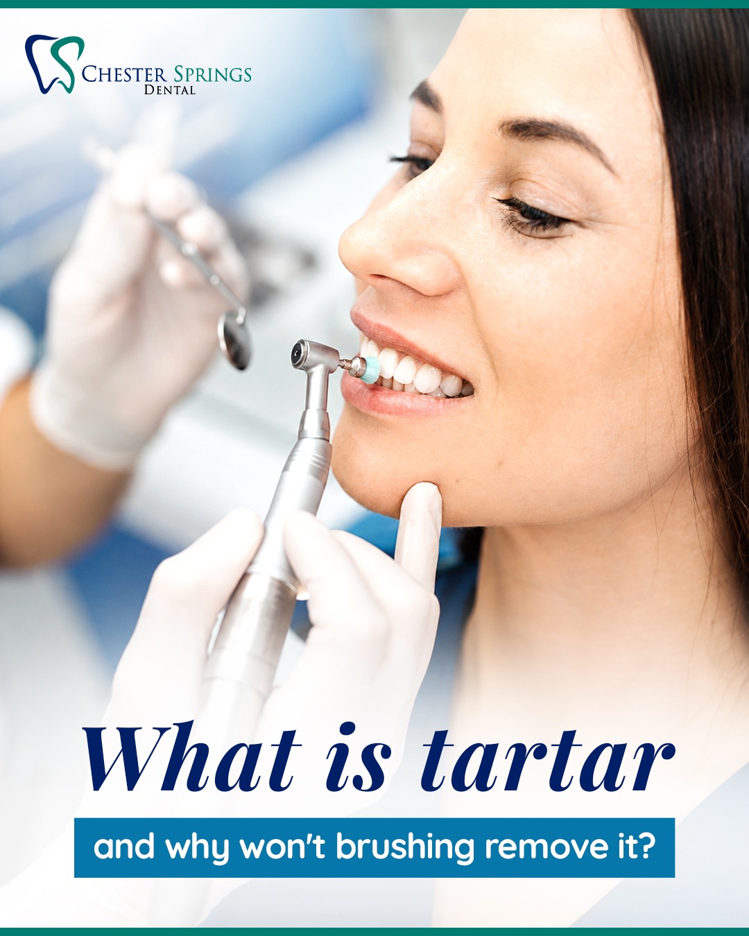 Brushing every day is essential—but sometimes, your smile needs a little professional help.
That’s where we come in. Keep your smile feeling fresh, clean, and cared for with regular dental visits.
Is it time for your next cleaning? Schedule your appointment with Chester Springs Dental today!
📞 (610) 458-5858
🌐 ChesterSpringsDental.com/contact-us
#ChesterSpringsDental #DentalCleaning #HealthySmile #OralHealth #PreventiveDentistry #dentalcaremalang