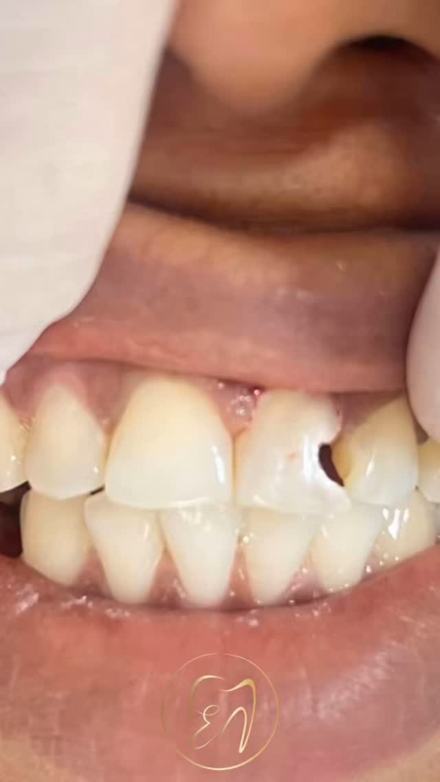 Volte a sorrir com segurança!
🦷✨