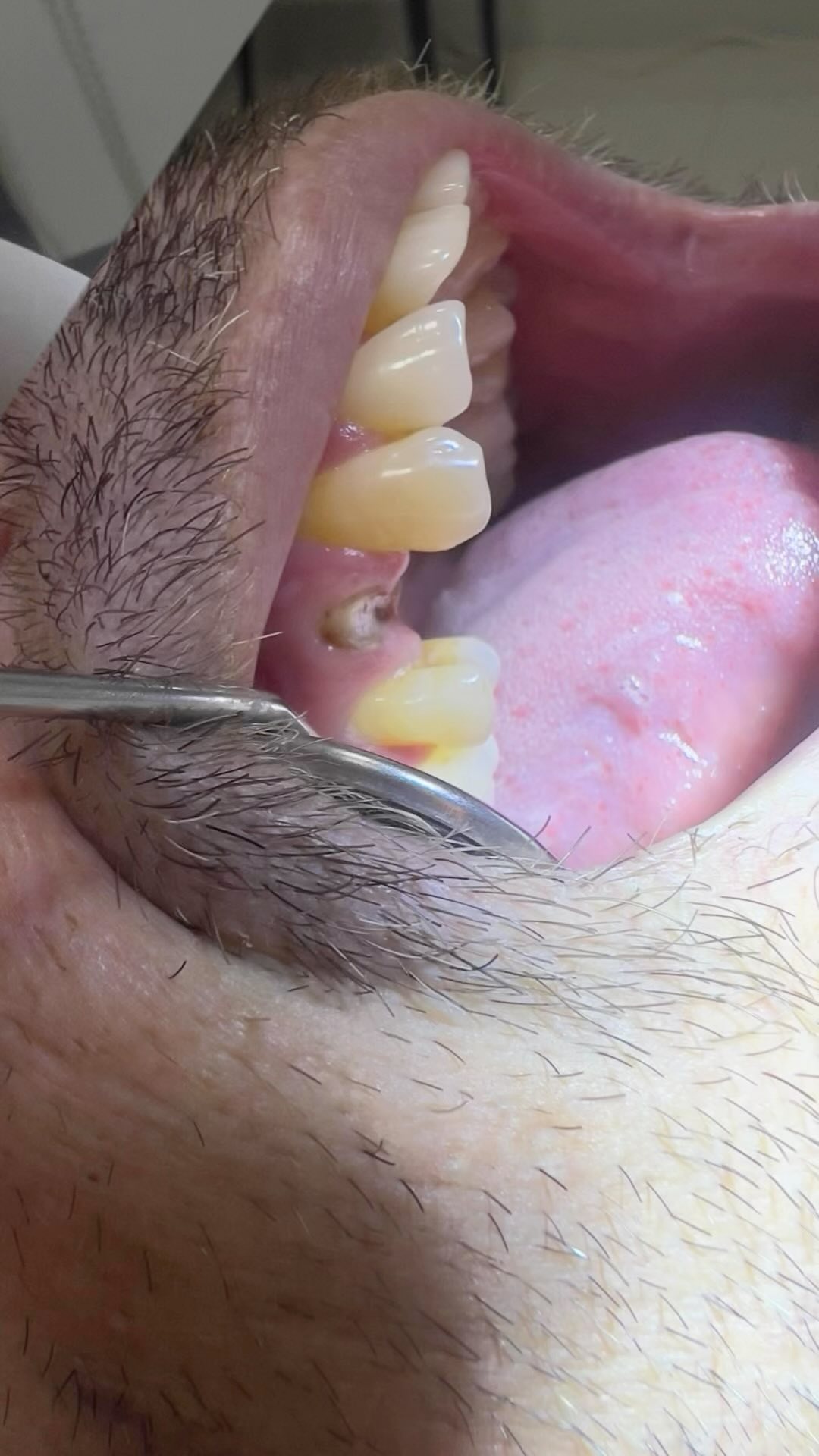 Resgatando a função, estética e naturalidade!
🦷✨🤍