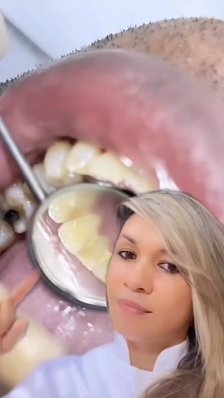 Evite complicações e vá ao dentista regularmente.
Aqui você agenda o seu horário e faz todo tratamento dentário com profissionais altamente capacitados.
•AGENDE O SEU HORÁRIO
📞71 99614-1014