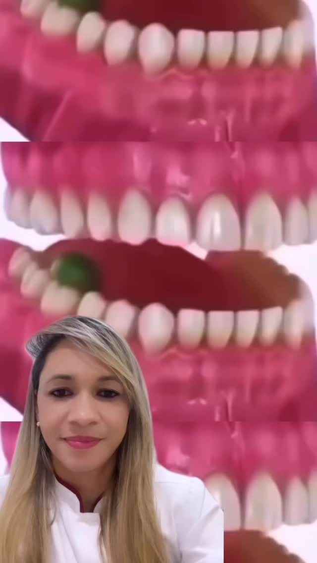 A cárie se inicia de forma silenciosa! Parece inofensiva, uma manchinha branca, resultado do acúmulo de placa bacteriana e restos alimentares. Mas se não for tratada, evolui rapidamente e pode comprometer toda a estrutura do dente!
A boa notícia é que a prevenção é simples, escovação correta, uso do fio dental e visitas regulares ao dentista.
A prevenção começa na sua rotina e se fortalece no consultório odontológico 🦷💫