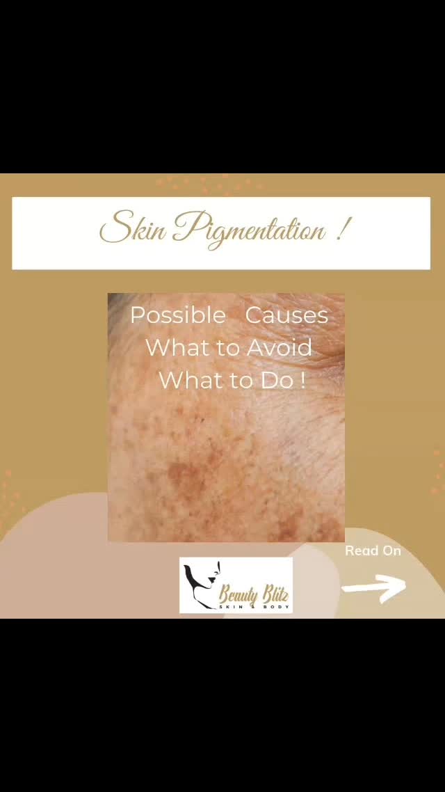You've tried the Peels, Microdermabrasions, scrubs, etc.
Only to find the condition always comes back๐จ๐ฅ
The thing is, these conditions usually take years to form. Therefore, a quick treatment is not going to fix it ๐
So here are some tips to help the condition or, at the very least, prevent ir from getting worse๐จ
๐ฟ Before starting using/doing anything on your skin, get a professional assessment.
๐ฟUse products with active ingredients recommended by a professional
๐ฟAvoid Sun Exposure at all cost and use a high-quality SPF 30-50
๐ฟBe consistent, and don't give up. Remember, this has taken years to form.
How we can helpโผ๏ธ
We are a collective of skin professionals with over 40 years of experience. Together, we have
Collated skin programs to suit individual needs.
Was this helpful? Save for later & share with a friend ๐
@beautyblitzonqueen
@beauty
.
.
.
.
#skincaretips
#skincorrection #pigmentation
#darkskin #sundamaged #hormones #DNA
#skinexperts
#brisbanefacials
#advancedskincare
#Beautyblitzonqueen
#skincareblogger