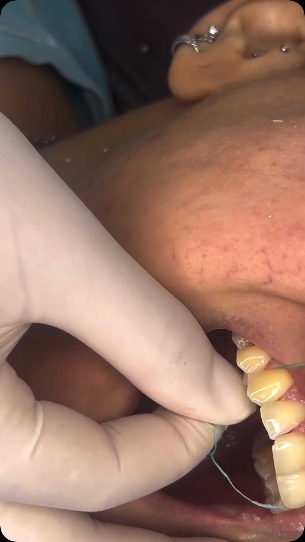 Você já passou o fio dental hoje?
*Inclua o fio dental na sua rotina, se quiser ter dentes saudáveis em boca!
🦷✨