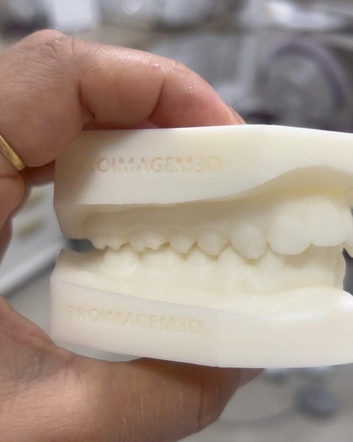 Você tem os dentes tortos? Desalinhados? Com o tratamento ortodôntico podemos alinhar o seu sorriso e devolver qualidade de vida.
O especialista em ortodontia é o profissional capacitado para devolver o seu sorriso de forma harmônica e segura. Venha conhecer os nossos aparelhos convencionais e estético!
🦷
