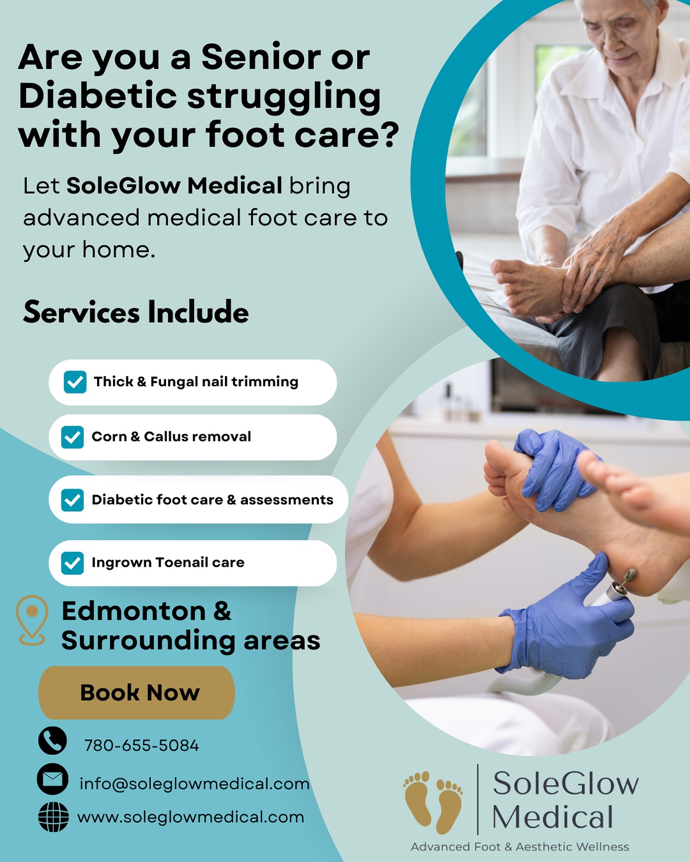As we age, caring for our feet isn’t as easy as it used to be.
Bending, trimming, and checking for sores can be difficult — and small issues can quickly become serious if left untreated.
For those with diabetes, foot care is even more critical. Poor circulation and nerve damage mean a tiny cut or ingrown nail can lead to major complications.
That’s why regular, professional foot care is more than just a luxury — it’s a necessity for staying mobile, independent, and pain-free.
At SoleGlow Medical, we understand these challenges — and we’re here to help. We bring advanced foot care right to your door, so you can stay safe, comfortable, and confident.
📍 Serving Edmonton & Surrounding Areas
📞 780-655-5084
📩 info@soleglowmedical.com
🌐 www.soleglowmedical.com
#SeniorFootCare #DiabeticFootCare #SoleGlowMedical #MobileNursing #HealthyFeetHappyLife