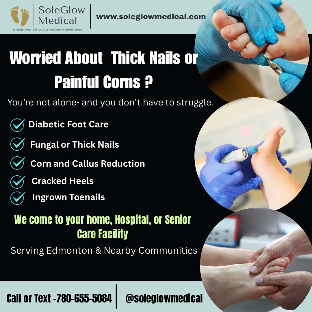 👣 Struggling with Thick Nails or Painful Corns? You’re Not Alone. We Can Help!
At SoleGlow Medical, we bring advanced foot care right to your doorstep—whether you’re at home, in hospital, or a senior care facility.
✅ Diabetic Foot Care
✅ Fungal or Thick Toenails
✅ Corn & Callus Reduction
✅ Cracked Heels
✅ Ingrown Toenails
📍Serving Edmonton & Surrounding Communities
💼 Care provided by Foot Care Nurse (RN)
✨ Compassionate, Professional, and Mobile—because your comfort matters.
📞 Call or Text Now: 780-655-5084
📱 Or DM us @soleglowmedical to book your visit!
💙 Healthy feet are just one visit away.