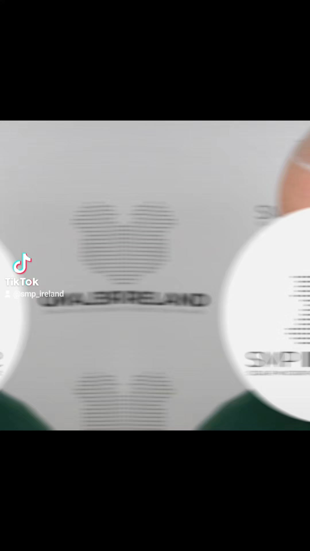 Scalp Micropigmentation is a pmu procedure that uses a method similar to a tattoo to replicate hair follicles on your scalp. No hair grows from this procedure.
At SMP Ireland:
We tailor each hairline to every individual client.
We restore the image of having a full head of hair
We only use the highest standard quality products to ensure you get the best look.
No bleeding, no swelling and no scabbing.
Any redness disappears within 24 hours.
Some of the things we tackle are the following:
Thinning hair
Receding hairlines
Add hair density
Create symmetry
Male pattern baldness
Female pattern baldness
Alopecia
Hair loss.
FUT and FUE scarring camouflage
If interested DM, text, call email or check my website for quotes.
All consultations are free and payment plans are available.
Please feel free to follow to see our customer transformations.
Based in Limerick city, Ireland serving Ireland.
#beboldnotbald #trusttheprocess #pmuireland #smpireland #limerickcity #limerick
#limerickbusiness #bald #hair #scalpmicropigmentationireland #hairloss #balding #beautyireland #aestheticireland #baldingsolutionireland #confidencerestored