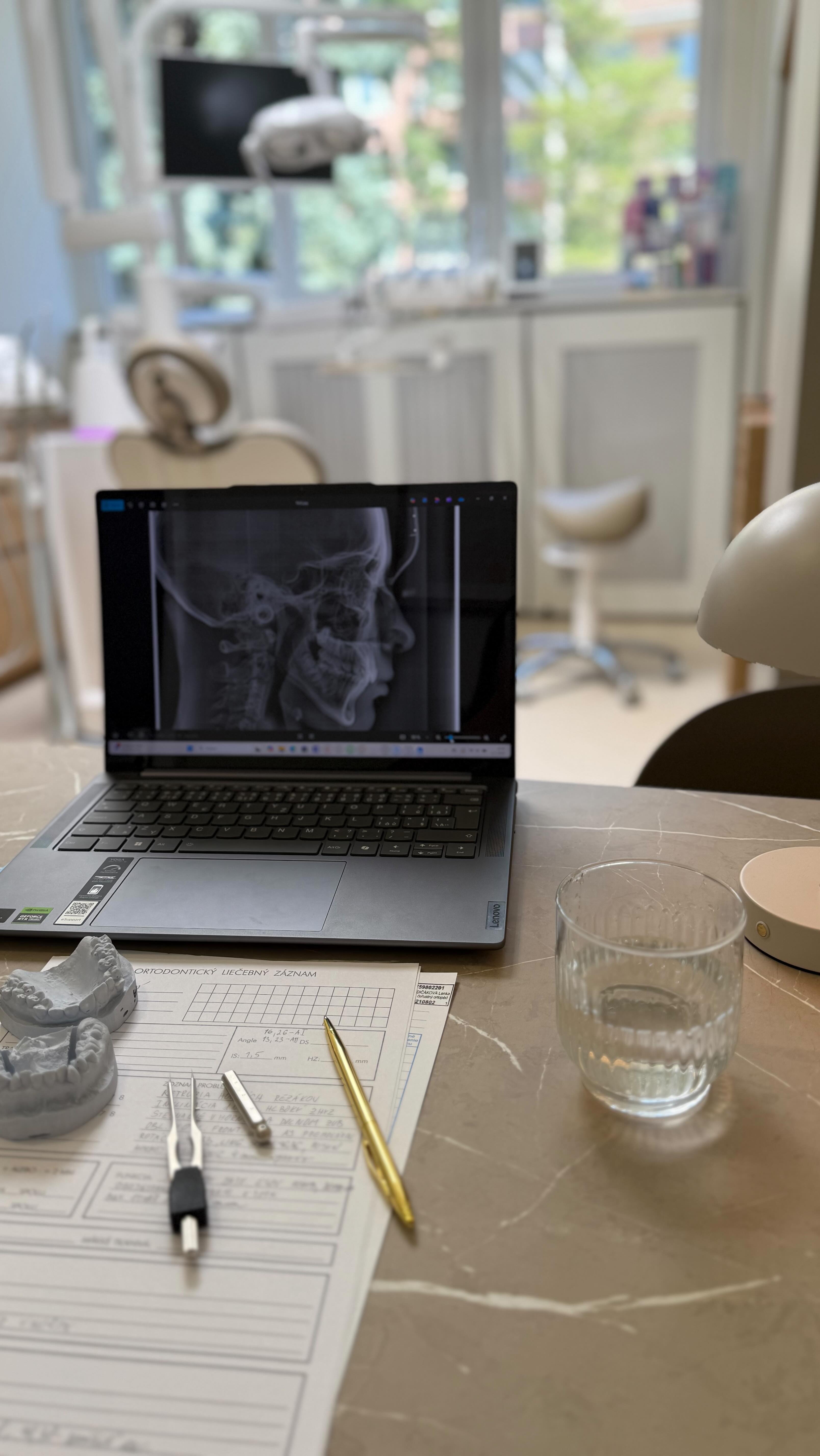 ✨ Vstupné čeľustno-ortopedické vyšetrenie a analýza ✨
Je kľúčovým krokom pri každom type liečby zubnými strojčekmi. Len na základe dôkladného vyšetrenia a analýzy vieme pripraviť individuálny liečebný plán pre krásny a zdravý úsmev.
Čo všetko zahŕňa?
✅ založenie dokumentácie
✅ intraorálne vyšetrenie – postavenie zubov a čeľustí
✅ extraorálne vyšetrenie
✅ fotodokumentácia
✅ odtlačky a voskový zhryz
✅ zhotovenie študijných modelov
✅ analýza modelov a TELE-RTG
✅ zostavenie liečebného plánu
📍 Ambulancia čeľustnej ortopédie Dr. Mandičáková
Tatranská 25, Košice
📞 0911 212 124
🌐 www.drmandicakova.sk
Začiatok liečby do 10 dní. #drmandicakova #ortodoncia #zubnystrojcek #rovnezzuby #kosice #strojcekypredeti