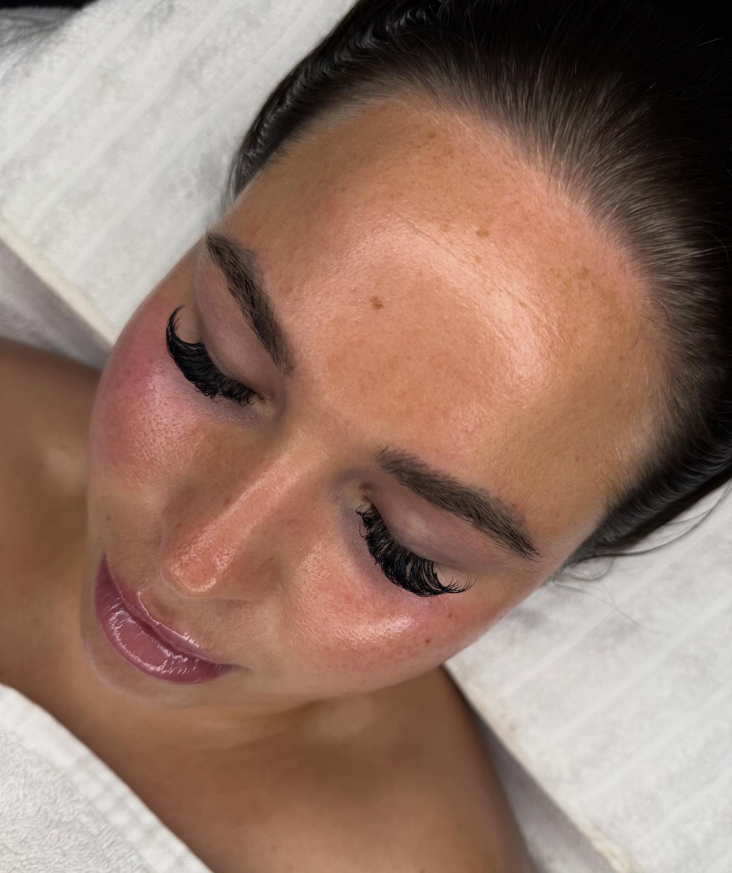 𝙇𝙪𝙭𝙪𝙧𝙮 𝙙𝙚𝙧𝙢𝙖𝙥𝙡𝙖𝙣𝙚 💕💫
Just look at that glow 😍
My gorgeous client’s skin is absolutely glass-like after her dermaplaning treatment.
This luxe exfoliation gently removes surface buildup and fine vellus hair, leaving the skin buttery-smooth and radiant. Perfect before an event or as part of your monthly glow routine.
Refined, radiant skin — exclusively at Lily-Rose Beauty. 💫
Message me to book your glow up! Currently on sale for £46.50💸💸
#dermaplane #facial #facialglow #skin #dermaplanefacial #mapperley #nottingham #LRB
#lilyrosebeauty